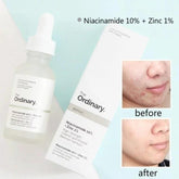Ordinary  Skin Brightening Niacinamide Serum